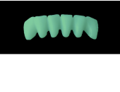 Cod.C11Facing : 10x  wax facings-bridges,  MEDIUM, Overlapping, TOOTH 43-33, compatible with Cod.A11Lingual,TOOTH 43-33 for long-term provisionals preparation